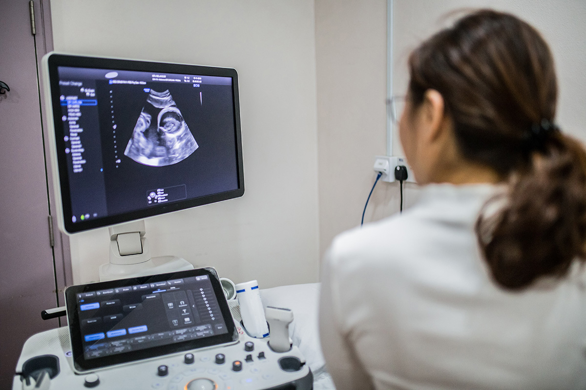 Un juge bloque la loi de l'Iowa interdisant les avortements après un rythme cardiaque fœtal détectable
